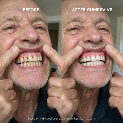 Auveer™ GUM REVIVE