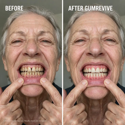 Auveer™ GUM REVIVE