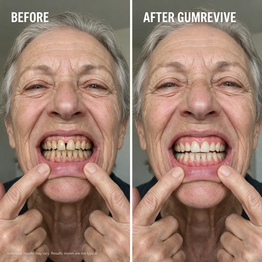 Auveer™ GUM REVIVE